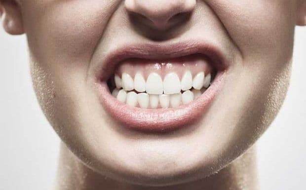 Dores de cabeça e estalos na mandíbula? Pode ser Bruxismo ou DTM.